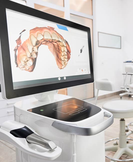 iTero Scanner